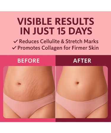 ADEUS Pink Rose Intensive Cream Firming Anti-Cellulite & Stretch Mark Body Rosa Crema with Asiatica & Seaweed Extract Moisturizing & Smoothing Skincare 300 g (300g, Pink Rose) - Buy Online on GoSupps.com