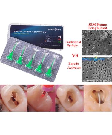 Easyinsmile Soft Bendable Dental Endodontic Activator Tips - Durable Polymer Material - Buy Online on GoSupps.com