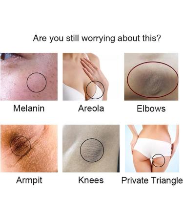 Vitamin Underarm Whitening Deodorant Stick Vitamin C Underarm Whitening Balm Deodorant Womens Moisturizing For Intimate Area Underarms Armpits Knees Elbows and Inner Thighs - Buy Online on GoSupps.com
