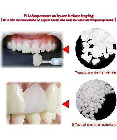 Temporary Tooth Repair Kit - Moldable Fake Teeth & Thermal Fitting Beads for Quick Tooth Replacement | White Teeth Repair Solution - Buy Online on GoSupps.com