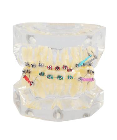 BigKing Orthodontic Model Dental Orthodontic Treatment Malocclusion Study Tooth Model with Wire Chain
