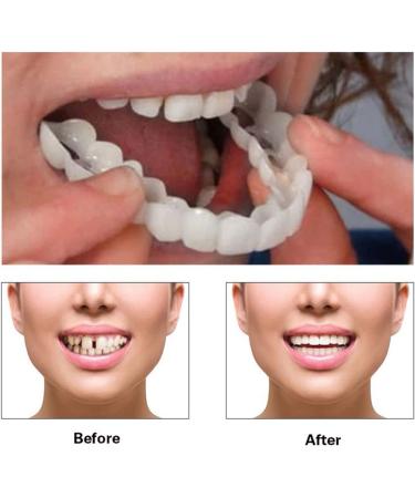 Mxrfactory Teeth Prosthesis Pebble Gel Snap-On Smile - Temporary Cosmetic Tooth Set for Men | 10 Pairs Removable Braces Cover & Repair - Buy Online on GoSupps.com
