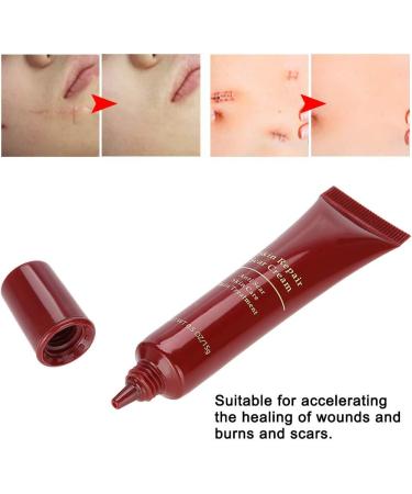 Scar Removal Cream | Accelerate Wound Healing, Repair Elastic Collagen Fibers | Burns & Scars Treatment - Buy Online on GoSupps.com