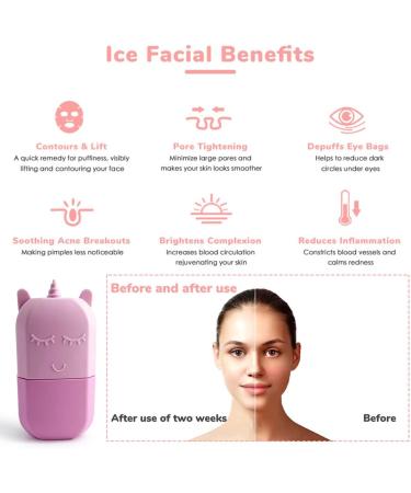 Ice Roller for Face - Portable Silicone Skin Care Tool | Reusable Ice Facial Roller to Brighten & Reduce Fine Lines (Pink - Buy Online on GoSupps.com