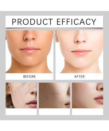 XINRAN Vitamin C cream face lotion body lotion moisturizer turmeric vitamin C body cream turmeric face cream vitamin C faces body creams uneven clay dry skin 4 pieces - Buy Online on GoSupps.com