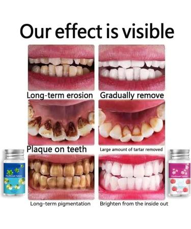 TeetClean Mouthwash Tablets | Natural Teeth Whitening & Probiotics | Herbal Super Whitening (Peach) - International Shipping Available - Buy Online on GoSupps.com