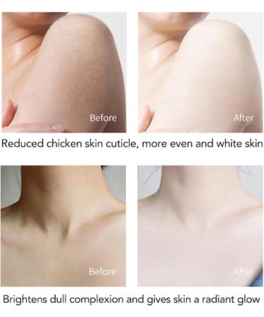 Body Exfoliator - Coffee Prowder Exfoliating Body Scrub - Nourishing Body Scrub - Powerful Exfoliator - Quick Moisturizer - Fade Dark Spots - Firming Skin - Care Face and Body Nourish - Buy Online on GoSupps.com