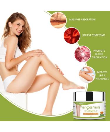 Varicose Veins Cream: Fast Relief for Phlebitis, Angiitis, Inflammation, and Spider Veins - Buy Online on GoSupps.com