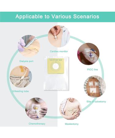 Waterproof Ostomy Protector G Tube Shower Cover Transfer Set 60pcs Peritoneal Dialysis Accessories Disposable Colostomy Bag for PD Port Catheter Supplies - 60 Count - Buy Online on GoSupps.com