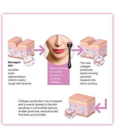 540 Titanium Microneedle Derma Roller Skincare Tool for Men & Women Reduce Facial Wrinkles Hair Loss Age Spots Stretch Marks Face Roller Boost Hair Regrowth & Beard Growth Roller (1mm) - Buy Online on GoSupps.com