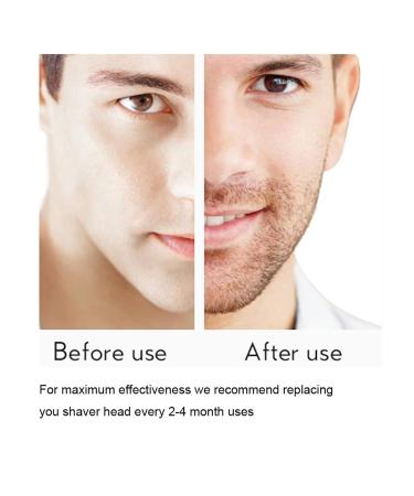 Shaver Replacement Head 6PCS for Microtouch Solo | Includes 2PCS Clean Brush & Box - International Shipping Available - Buy Online on GoSupps.com