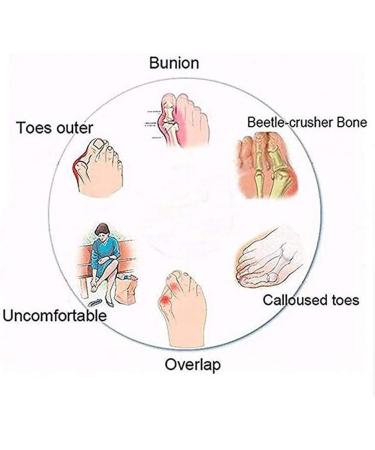 QYY Big Toe Foot Correction Sandal - Orthopedic Bunion Corrector for Men - Black Leather Casual Sandal - Size 10 - Buy Online on GoSupps.com