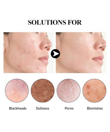 Activated Carbon Facial Mask Stick | Deep Clean & Moisturize with Camellia Seed Oil | Shrink Pores & Remove Acne (1.4oz - Buy Online on GoSupps.com