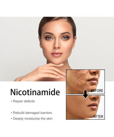 Sunnylas Niacinamide Freckles Removal Serum Niacinamide Spots Removal Serum Nicotinamide Serum for Blemishes Hydrating and Moisturizing Facial Essence (2 PCS) - Buy Online on GoSupps.com