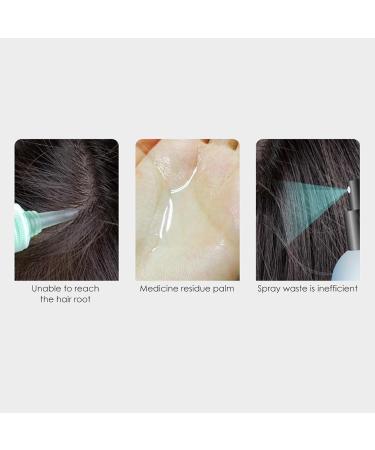 Oil Scalp Applicator Comb | Head Massage Brush | Hair Treatment Tools for Follicular Care - International Shipping - Buy Online on GoSupps.com