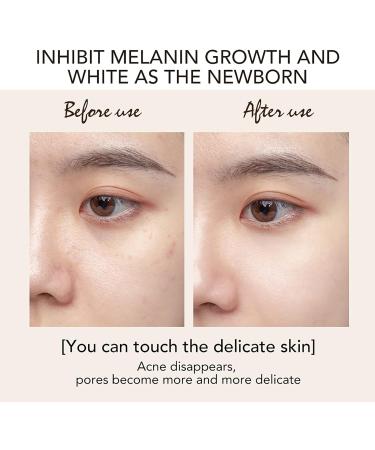 Kojic Acid Brightening And Replenishing Face Cream Blemishes Treatment Inhibit Skin Melanin With SPF35+ Anti-UVA & UVB Sunscreen For Black & Dark Skin - Buy Online on GoSupps.com