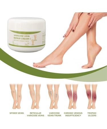 Cream for Varicose Veins for Legs 50G Natural Oils Formula Phlebitis Relief Treatment Soothing Cream for Anti Varicose - Buy Online on GoSupps.com