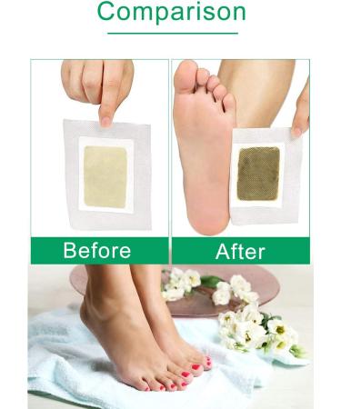 40 Ginger Foot Pads for Better Sleep, Easy Foot Care with Natural Ginger & Bamboo Vinegar Ingredients - Buy Online on GoSupps.com