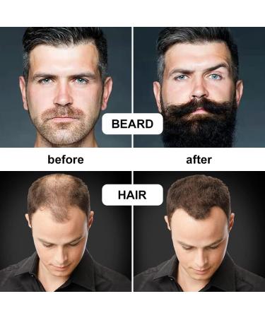 URAQT 6 Piece Beard Growth Kit with Titanium Microneedle Derma Roller - Beard Grooming Tools for Men - Buy Online on GoSupps.com