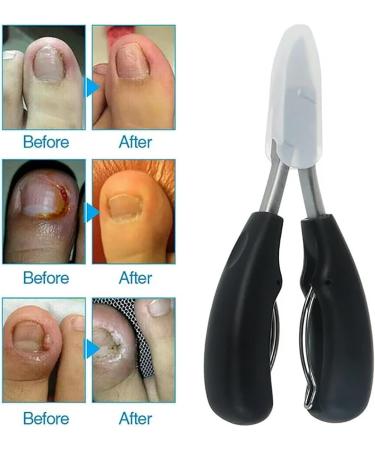 MART Deals LTD Precision Toenail Clippers for Thick or Ingrown Toenails - Nail Clippers - Professional Large Nail Clipper Grooming Tools - Cuticle Cutter - Nail Cutter - Buy Online on GoSupps.com