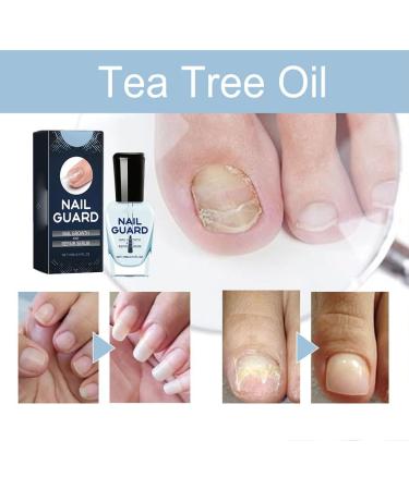 HOPASRISEE Onyxoguard Nail Growth and Repair Serum Onyxoguard Serum Nail Strengthener Nail Growth Serum Nail Growth and Strengthener Nail Serum for Strength and Growth (3) - Buy Online on GoSupps.com