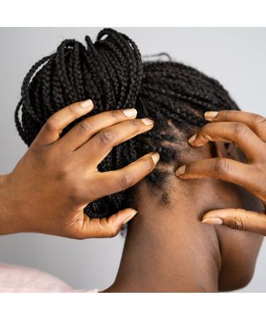 AromaHair Nourish Rejuvenating Anti-Itch Scalp Oil - Peppermint Tea Tree Jojoba | Dandruff Relief & Scalp Refreshment for All Hair Types - Buy Online on GoSupps.com