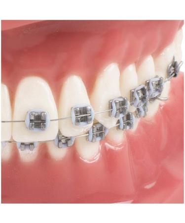 Orthodontic Teeth Model with Mental Brackets & Red Ligature - Tipodonto Dental Support for Treatment - Buy Online on GoSupps.com