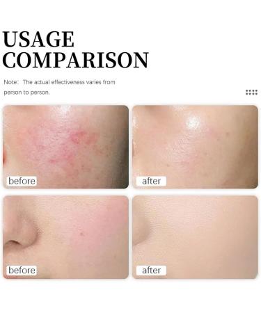  Orgrul Ocean Natural Soothing Face Cream for Women 118 ml Soothing Face Cream Nourishing Face Cream Facial Moisturizer (2 Pcs) - Buy Online on GoSupps.com