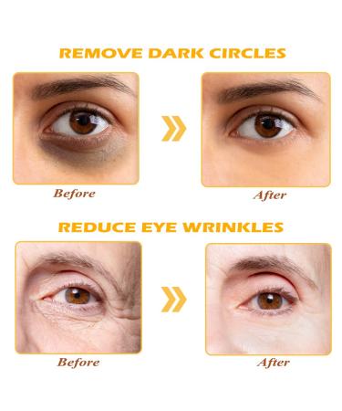 Devimic 24K Gold Eye Mask - 30 Pairs for Dark Circles and Puffiness | Under Eye Patches for Puffy Eyes and Eye Bags - Gel Eye Mask for Face Skin Care - Buy Online on GoSupps.com