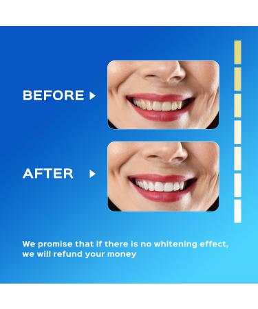 Teeth Whitening Kit - 16X LED Light Rechargeable Gel Pen & Strips 30ml Carbamide Peroxide 3ml Remineralization Gel 15-Minute Timer - Safe for Sensitive Teeth - Buy Online on GoSupps.com
