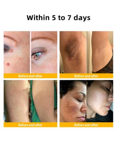 Bee Venom Cream Professional Bee Venom Cream Bee Venom Repair Cream for All Parts of The Body (2 Pack) - Buy Online on GoSupps.com