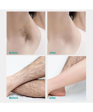Hair Removal Spray Foam | No Irritation Depilatory for Women & Men | Safe for Underarms Chest Back & Legs | All Skin Types - Buy Online on GoSupps.com