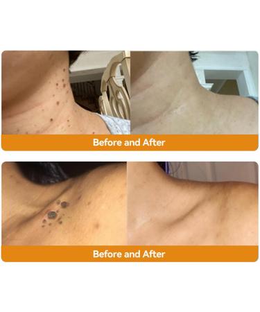 ZVLZVL Bee Venom Skin Treatment Cream - Fast & Effective Repair for Men & Women | 1 Fl Oz - Professional Skin Care Solution - Buy Online on GoSupps.com