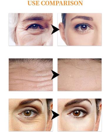 Dajidafu Soluble Film Eye Patches Anti-aging Hyaluronic Acid Moisturizing Eye Masks Skin Care Anti-Wrinkle Fine Lines Gel Patch - Buy Online on GoSupps.com