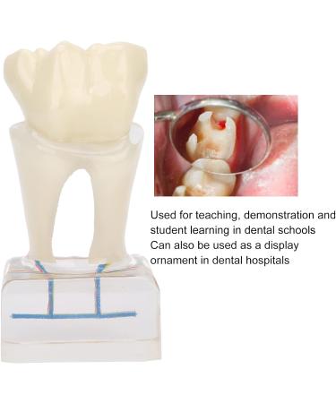 Professional Dental Nerve Model for Teaching | Resin Tooth Model for Students | International Shipping - Buy Online on GoSupps.com