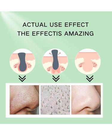 Tongyend Blackhead Removal Serum Nose Blackhead Remover Nose Strips Blackhead Pore Remover Cream Deep Cleansing Pore Strips&White Head Remover for Face Oil-Free Blackhead Remova Nose Strips 17ml - Buy Online on GoSupps.com