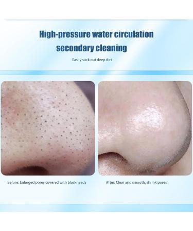 Nose Blac-khead Remover Electric - Electric Facial Pore Cleaner | 6 Suction Levels Rechargeable Adjustable Nose Blac-khead Remover | for Women and Men | Skin Care Tool for Unclogging Pores - Buy Online on GoSupps.com