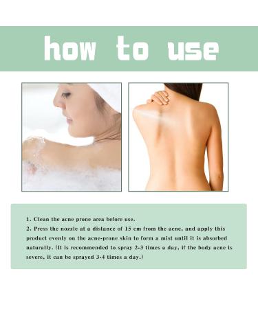 Back Acne Treatment Spray - 2% Salicylic Acid & Herbal Formula - Tea Tree Oil Body Acne Solution - 120ml 2pc - Buy Online on GoSupps.com