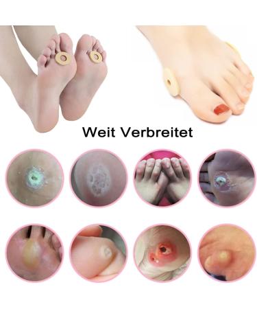 Catelves 30-Piece Chicken Corn Blister Protection & Foot Pain Relief - Heel Cushion & Corn Remover - Buy Online on GoSupps.com