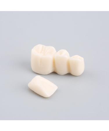 Buy Dental Diseases Teaching Study Adult Typodont Model - Realistic Tooth Demonstration for Education | International Shipping Available - Buy Online on GoSupps.com