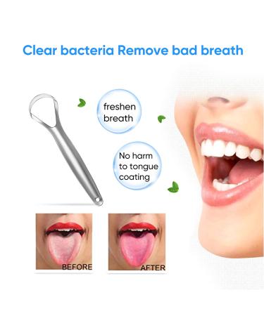 2 Pack Wide-Head Tongue Scraper Set with Travel Case for Adults & Kids - Medical Grade Metal Tongue Cleaners for Fresh Breath - Eliminate Bad Breath in Seconds - Black Case - 2 Count - Buy Online on GoSupps.com