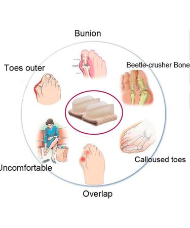 Orthopedic Gel Corn Cushions for Hallux Valgus - Reusable Foot Care Pads for Plantar Warts & Pressure Relief | Jinlingnb - Buy Online on GoSupps.com