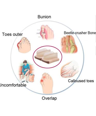 Orthopedic Gel Corn Pads for Hallux Valgus - Reusable Foot Care Pads for Plantar Warts & Pressure Relief - 1 Pair (4.5 x 3.5 cm) - International Shipping Available - Buy Online on GoSupps.com