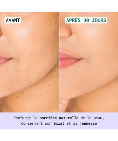 NUBIANCE - NubiAGE D-fense - Enriched with Bakuchiol - Moisturizing Face Cream - Anti-Aging Care - Reduces the Appearance of Wrinkles - Nourishing and Regenerating Formula - Buy Online on GoSupps.com