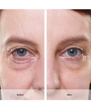Avon ANEW Platinum Instant Eye Smoother - Target Under Eye Bags, Puffiness & Wrinkles - Buy Online on GoSupps.com