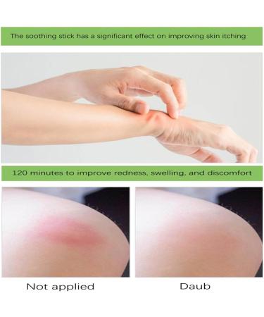 FAHXNVB Soothing Balm Stick - Mint Lithospermum Cream for Adults and Kids - Travel Size 0.5 Oz - Buy Online on GoSupps.com