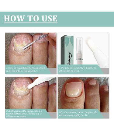 Nail Care Pen for Fungus - Aloe Vera Tea Tree Oil & Vitamin E | Nourish Fingernails & Toenails | International Shipping - Buy Online on GoSupps.com
