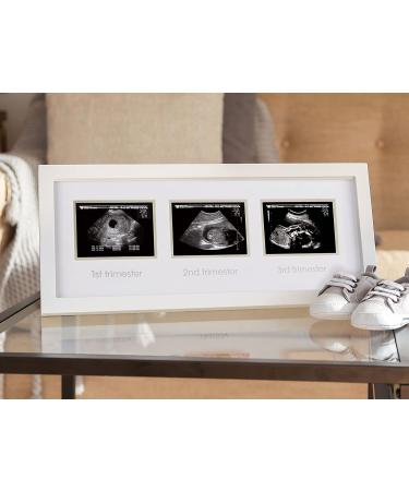 Pearhead Trimester Progression Sonogram Picture Frame - Gender-Neutral Pregnancy Milestone Keepsake for Baby Nursery D cor - Ideal Mother's Day Gift - Buy Online on GoSupps.com