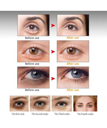 Pyrrhus Hexapeptide Eye Serum - Anti Aging & Firming Cream for Dark Circles and Puffiness - Buy Online on GoSupps.com