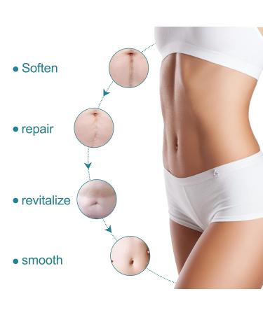 Medical Grade Silicone Scar Tape (1.6 x 60 Roll) - Scar Removal Strips for Acne, C-Section, Keloid Surgery - 1.5M Roll (S) - Buy Online on GoSupps.com